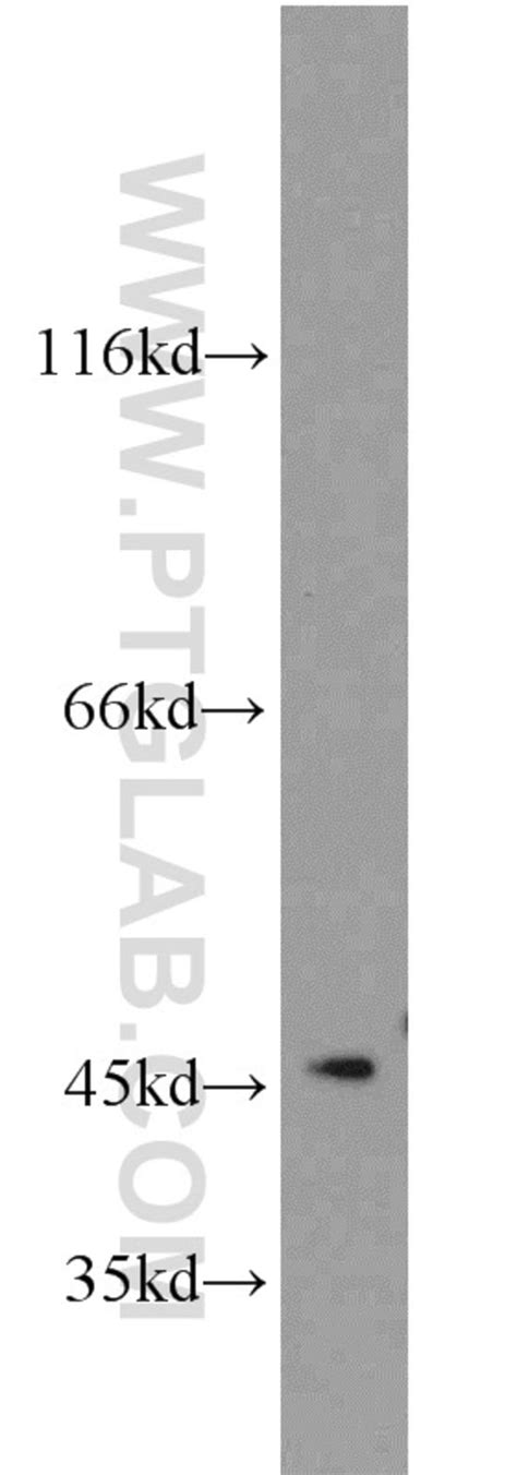 AGFG2 Rabbit anti Human Mouse Rat Polyclonal Proteintech 20 μL