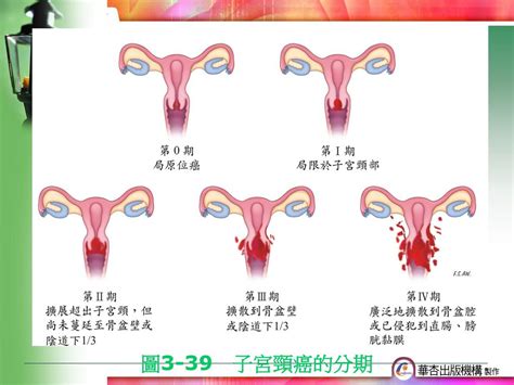 疾病與醫療 第八組 李佳霓 4a30h047 蕭筠蓓 4a 林淑玲 4a 吳佩樺 4a Ppt Download