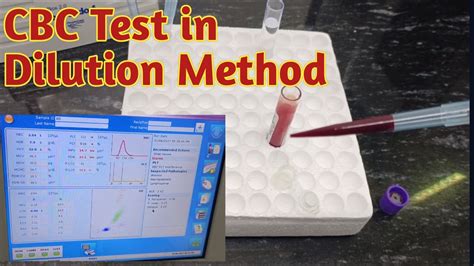 Cbc Dilution Method Cbc Manual Procedure Youtube