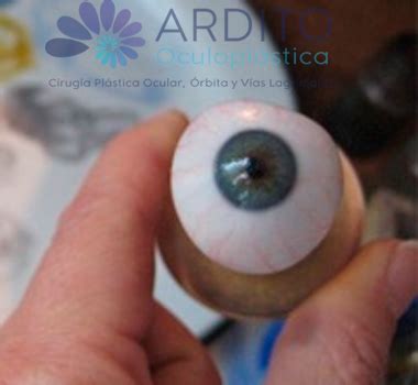 Oculoplastica Per Pr Tesis Oculares