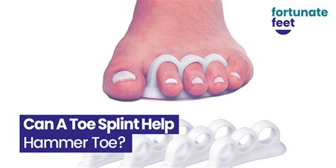 toe splint  hammer toe fortunate feet