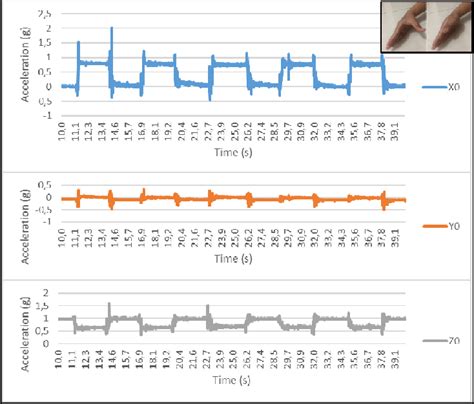 Acceleration of thumb abduction-adduction | Download Scientific Diagram