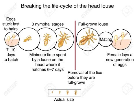 Breaking the life cycle of the head louse by wet combing before ...