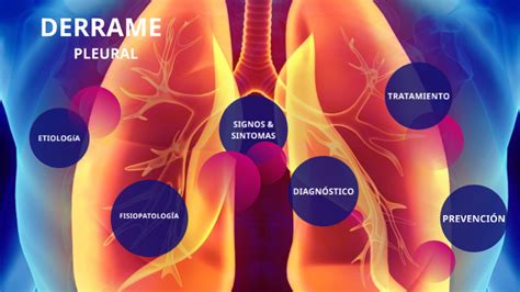 Derrame Pleural by Juliana Pabón on Prezi