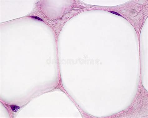 Adipose Tissue Stock Image Image Of Eosin Micrograph 117240715