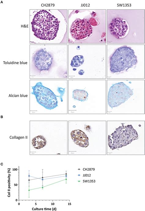 Chondrosarcoma Histology