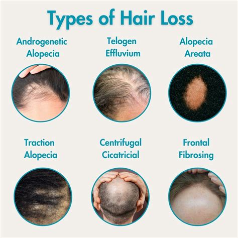 Hair Loss 101 Dermondemand