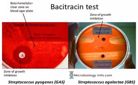 Bacitracin Susceptibility Test Procedure Uses And Interpretation