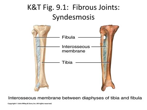 Ppt Ms1a Lecture 2 Joints And Ligaments Powerpoint Presentation