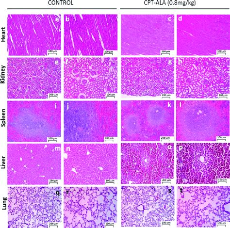 Hematoxylin And Eosin Staining Of Histological Slices From Cpt Ala And