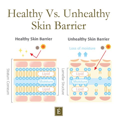 What Is Your Pores And Skin Barrier How To Defend It Life Peep