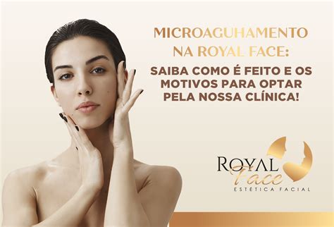 Microagulhamento Na Royal Face Conhe A Melhor O Procedimento Royal Face