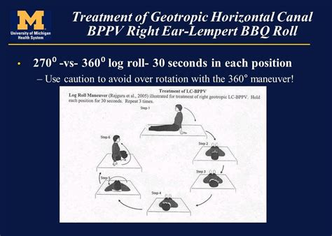 Pics Barbecue Roll Horizontal Bppv And Description Alqu Blog