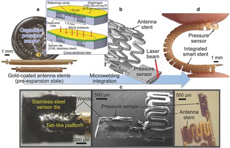 Enabling Angioplastyready Smart Stents To Detect Instent Restenosis