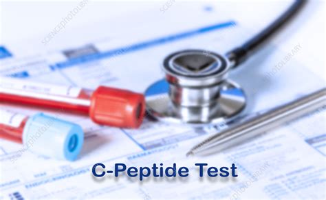 C-peptide test, conceptual image - Stock Image - F037/1140 - Science Photo Library