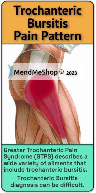 Greater Trochanter Bursitis Symptoms