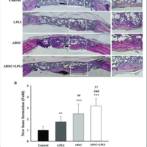 Histomorphological Analysis Of The Calvarial Defects At 16 Weeks