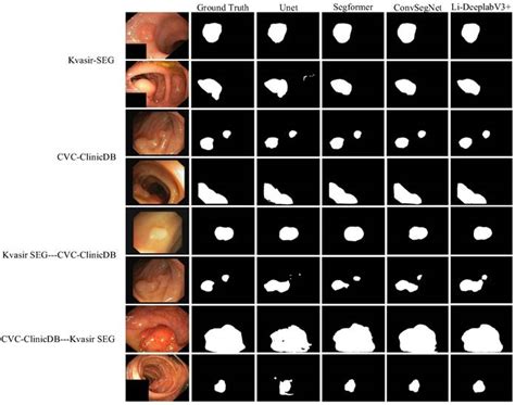 Lightweight Colon Polyp Segmentation Algorithm Based On Improved Deeplabv3