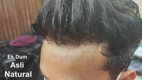 Hair Patch In Delhi 9899746489 Hair Patch Fixing In Delhi Amazing Hair Patch Centre Youtube