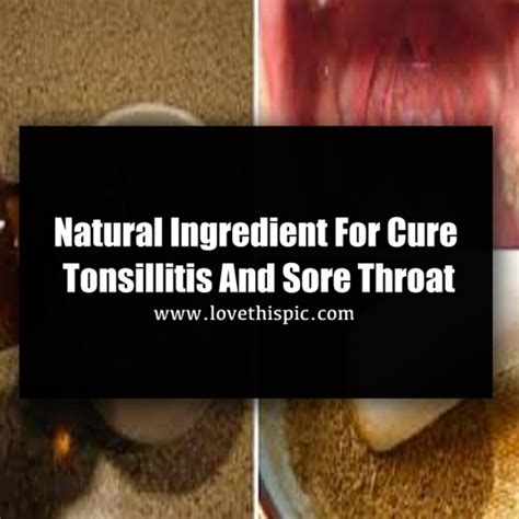 Natural Ingredient For Cure Tonsillitis And Sore Throat