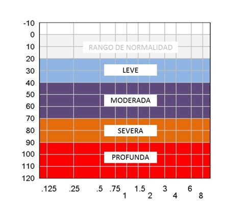 Tipos De Hipoacusia Share Rare The Best Porn Website