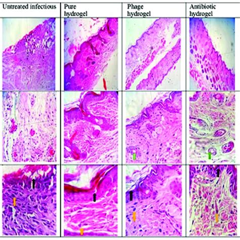 Histopathological Sections Of The Skin In Different Groups The Black