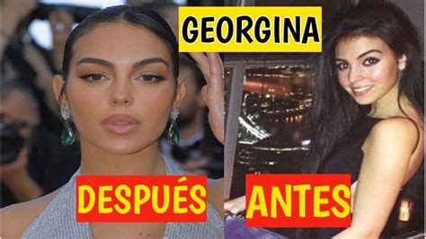 Georgina Rodríguez antes y después todos los retoques estéticos que