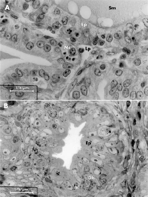 Light Micrograph Of Sham Operated Control Seminal Vesicle Epithelium Of