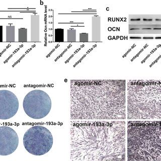 Downregulation Of MiR193a3p Correlates With Enhancement Of The