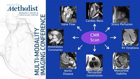 Cardiovascular Mr Basic Principles And Overview Of Technique Dipan