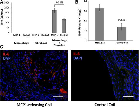 Monocyte Chemotactic Protein 1interleukin 6osteopontin Pathway Of Intra Aneurysmal Tissue