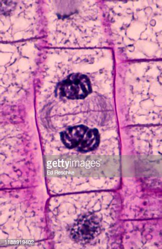 Mitosis Root Tip 400x High Res Stock Photo Getty Images