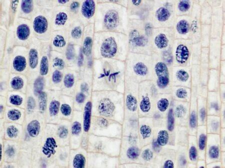 Stages Of Mitosis In Onion Root Tip