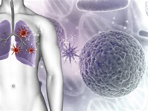 Šta je cistična fibroza - Aqualab