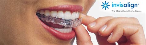 Invisalign Nevidljivi Aparati Ortodont Ortodoncija Ivanec