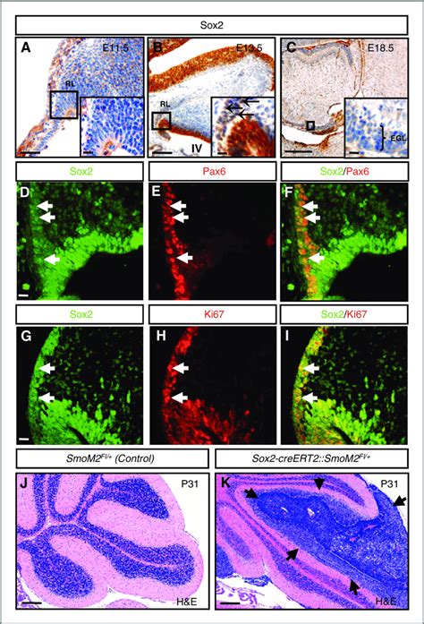 Sox2 Is Expressed In Early Cerebellar Granule Neuron Precursors Sox2