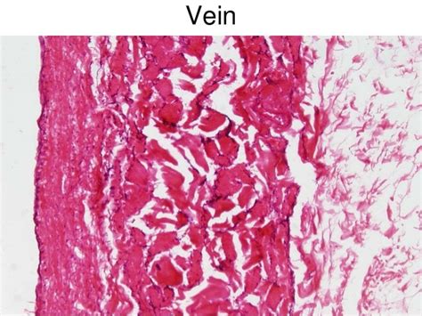 Histology Of Blood Vessels