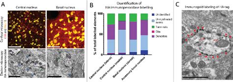 Cellular And Ultrastructural Localization Of Hm Dq Ha In The Nhp