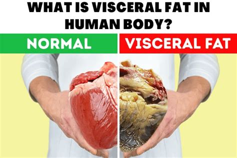 What Is Visceral Fat In Human Body?