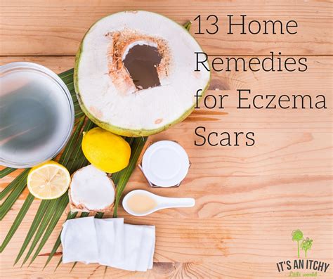 13 Home Remedies For Eczema Scars