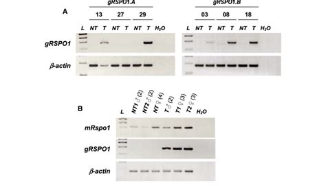 Transgene Expression A Rt Pcr Analysis Of The Grspo1 Transgene