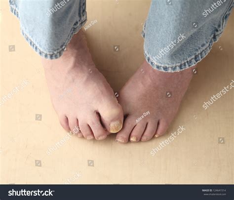 Foot Hiding Toe Photos Images Pictures Shutterstock