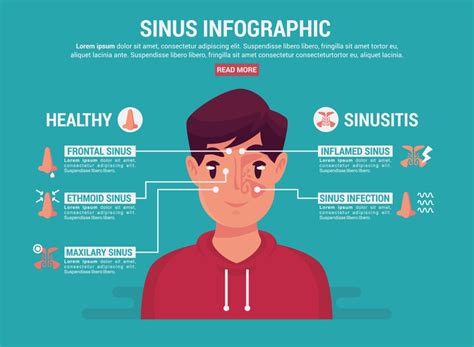 Sinus Infographic 171456 Vector Art At Vecteezy