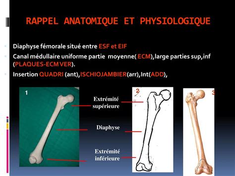 Ppt Fractures De La Diaphyse Femorale Powerpoint Presentation Free