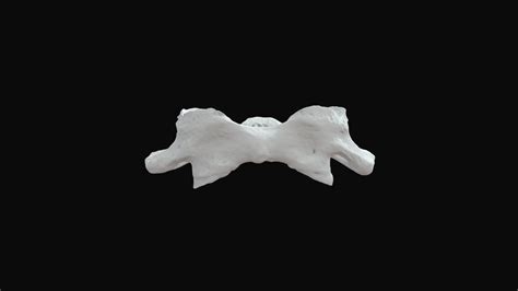 Atlas Vertebrae Download Free 3d Model By 19287762 A2af716 Sketchfab