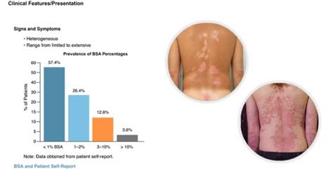 Psoriasis Clinical Picture