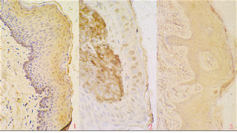 Immunohistochemical Staining For PEDF Expression In Healthy Skin