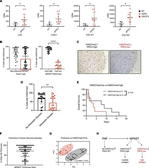 Jci Insight Prc Loss Drives Mpnst Metastasis And Matrix Remodeling