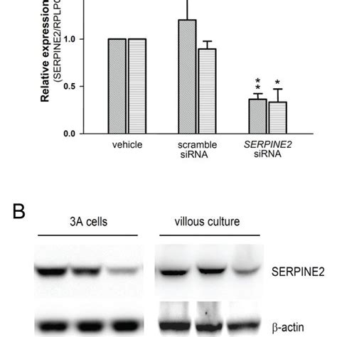 SERPINE2 SiRNA Decreases Expressions Of SERPINE2 MRNA And Protein In 3A