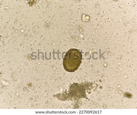 Free Lumbricoides Stock Photos Stockvault Net